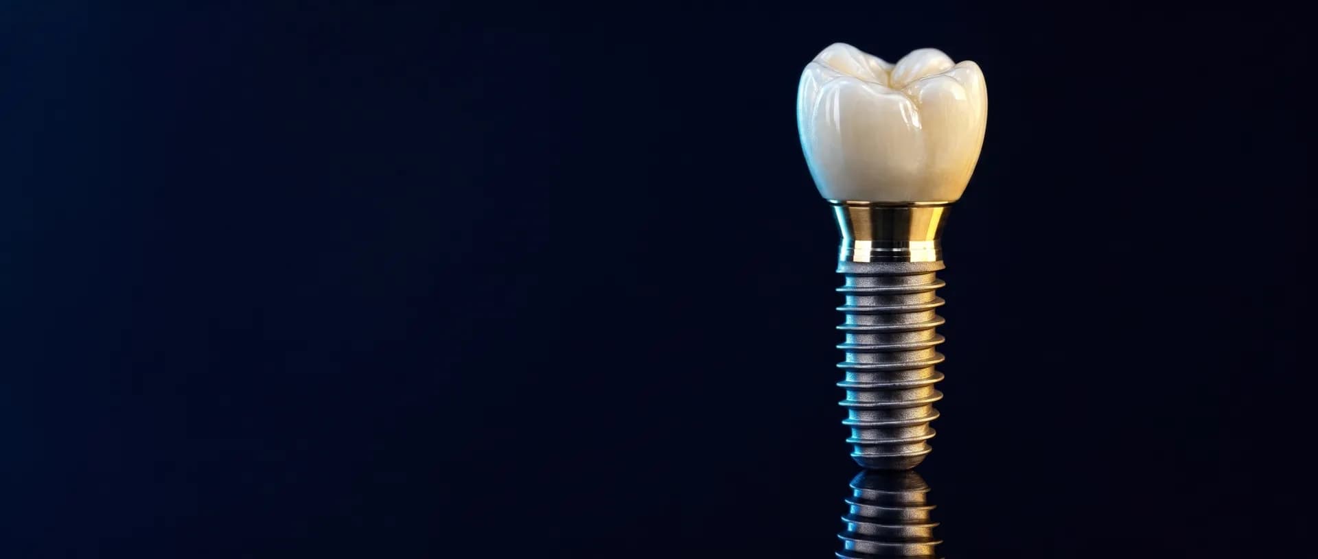 Implante dental unitario con corona de cerámica — Dental San Miguel